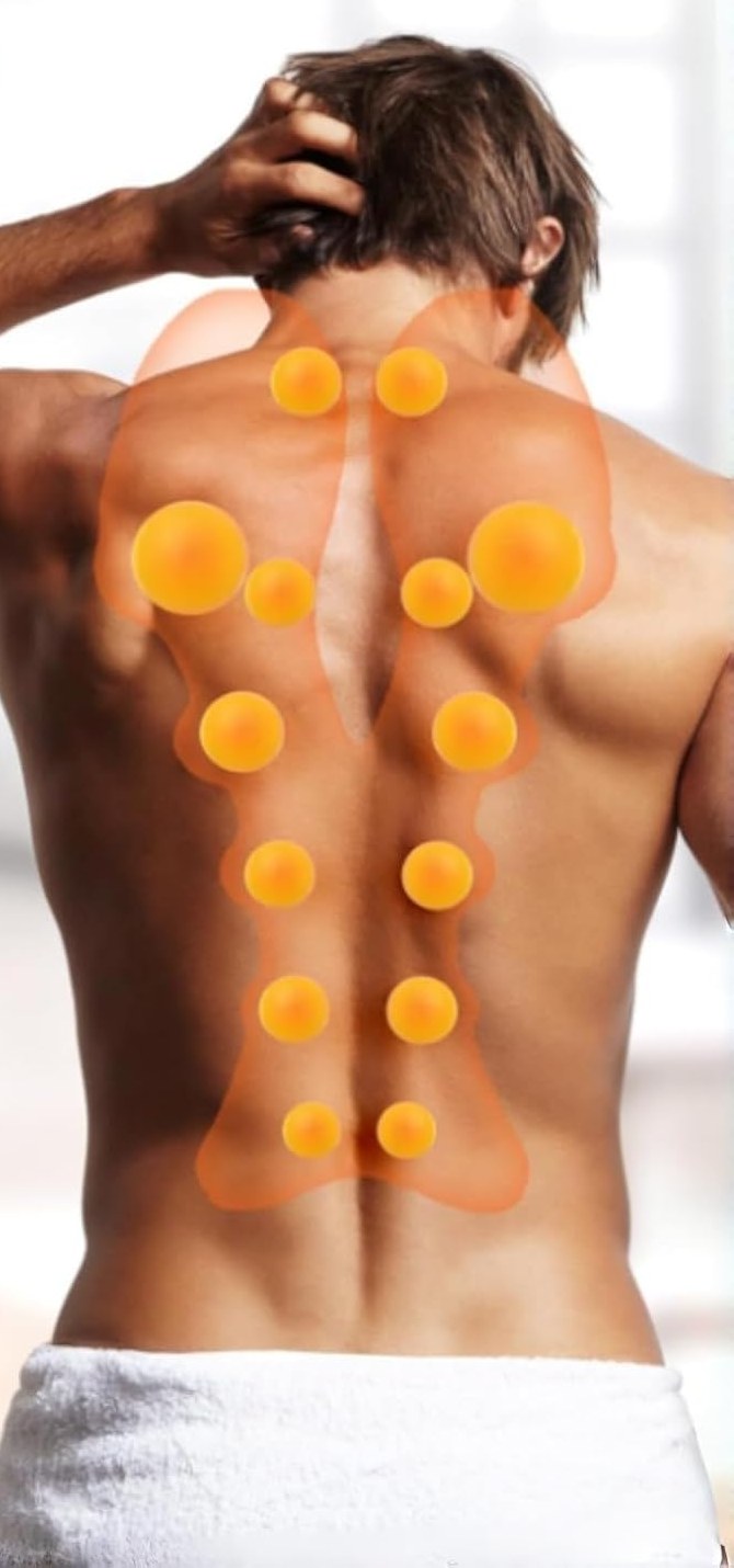 Back view with the four tension areas marked