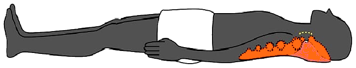 The baseline release